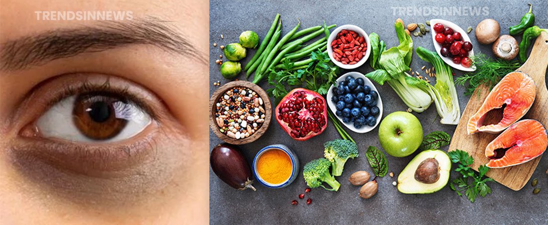 Dark Circles Under Eyes Elimination: Unlocking The Role Of Nutrients