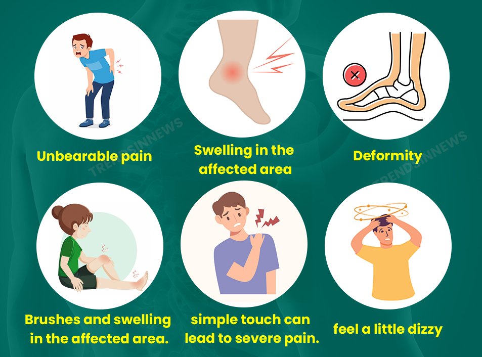 Symptoms of Breaking Bone 
