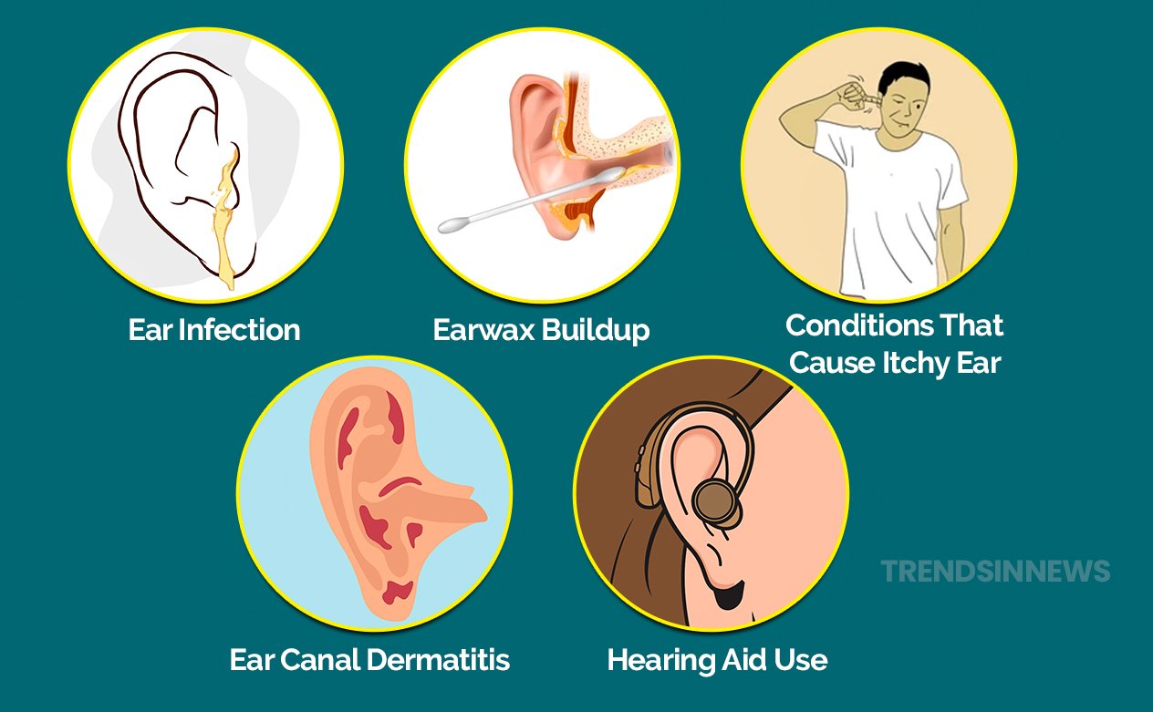 Why Do My Ear Itching; Causes and Treatment