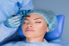 Alın Germe Ameliyatı: Genç ve Dinamik Bir Görünüm için Estetik Çözüm